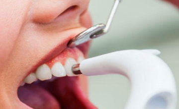 BrownField Dental cleaning service